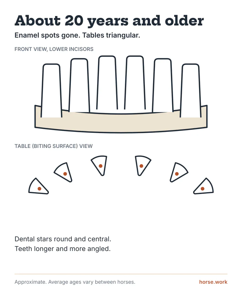 About 20 years: enamel spots gone, triangular biting surfaces